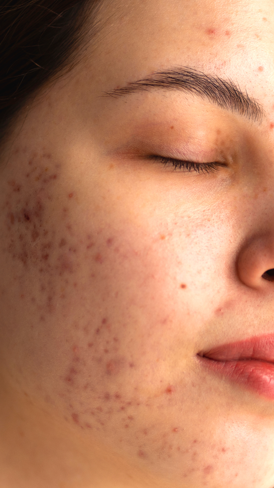 person,skin,head,face,adult,female,woman,lipstick,neck,freckle