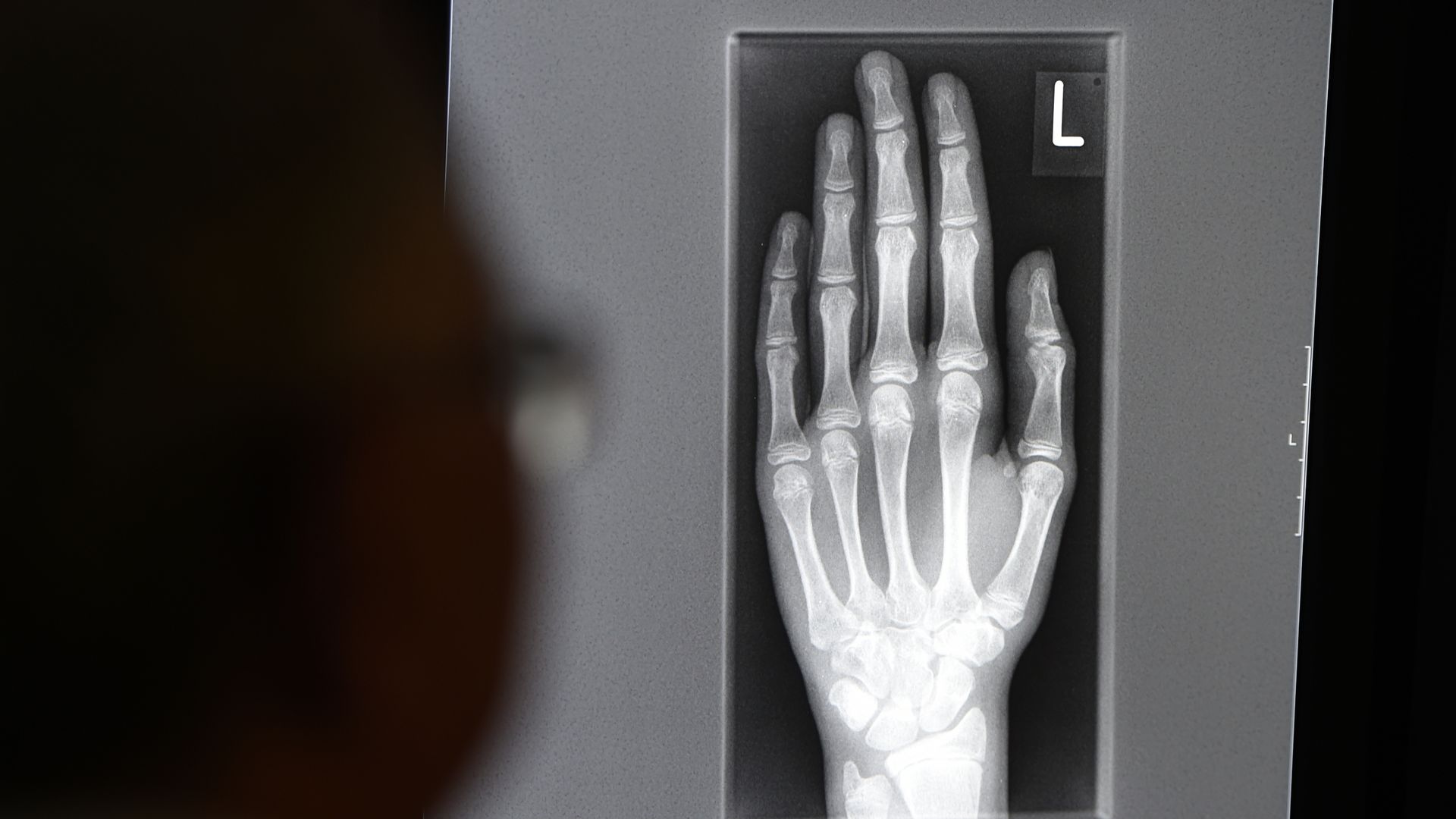 x-ray,brush,device,tool,toothbrush,person,head,face